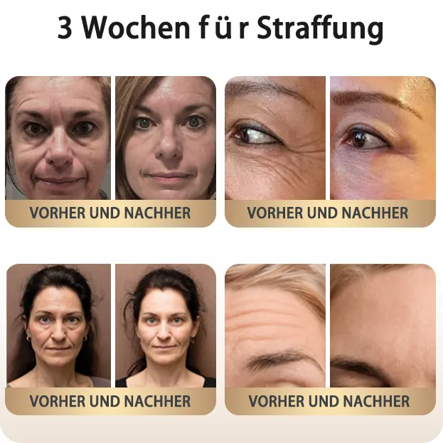 GMP-zertifiziertFurzero Retinol Kollagen  Faltenreduzierende Anti-Aging Creme