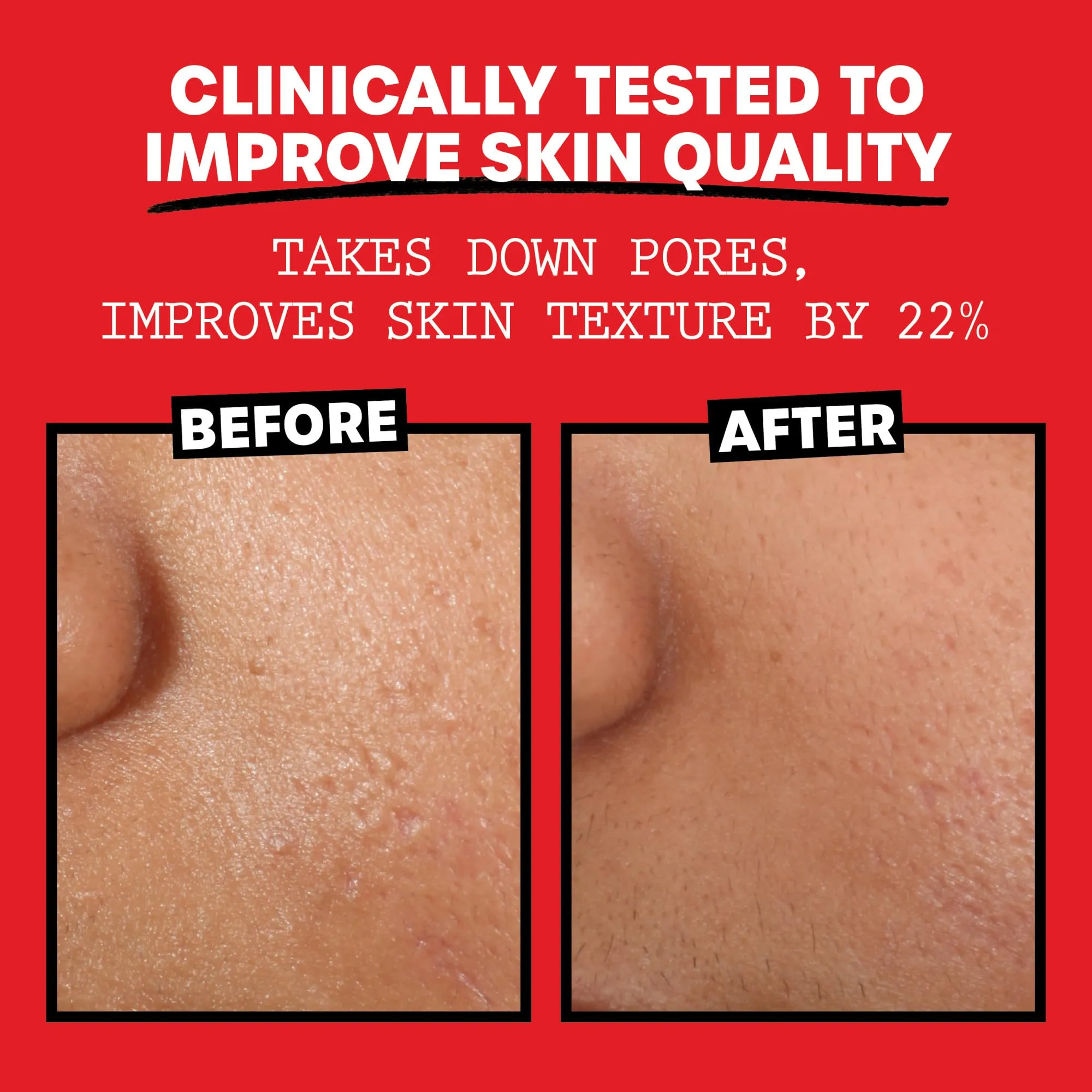 Thayers Alcohol-Free Rose Petal Witch Hazel Facial Toner for Glowing Skin, Soothing, Hydrating, Refreshing Toner for Normal and Combination Skin with Enlarged Pores, 355ml